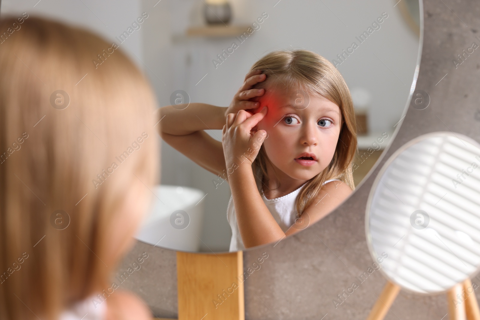 Photo of Suffering from allergy. Little girl looking in mirror and scratching her face at home