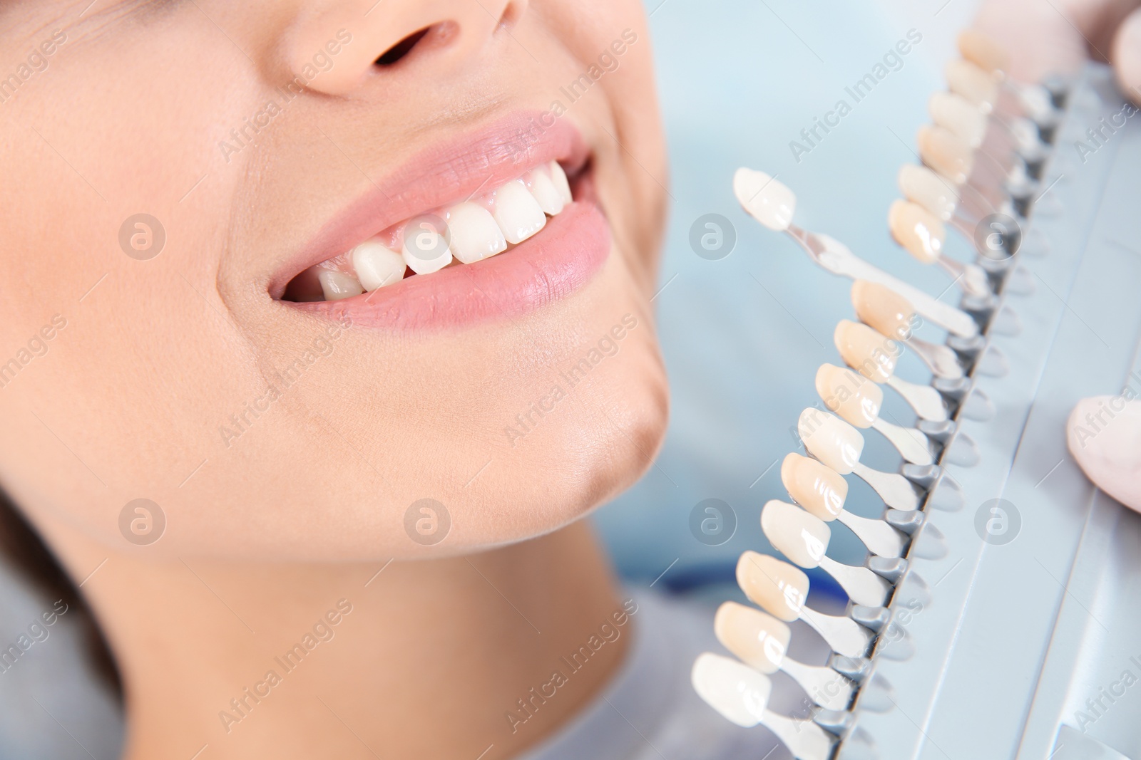 Photo of Dentist selecting patient's teeth color with palette in clinic, closeup