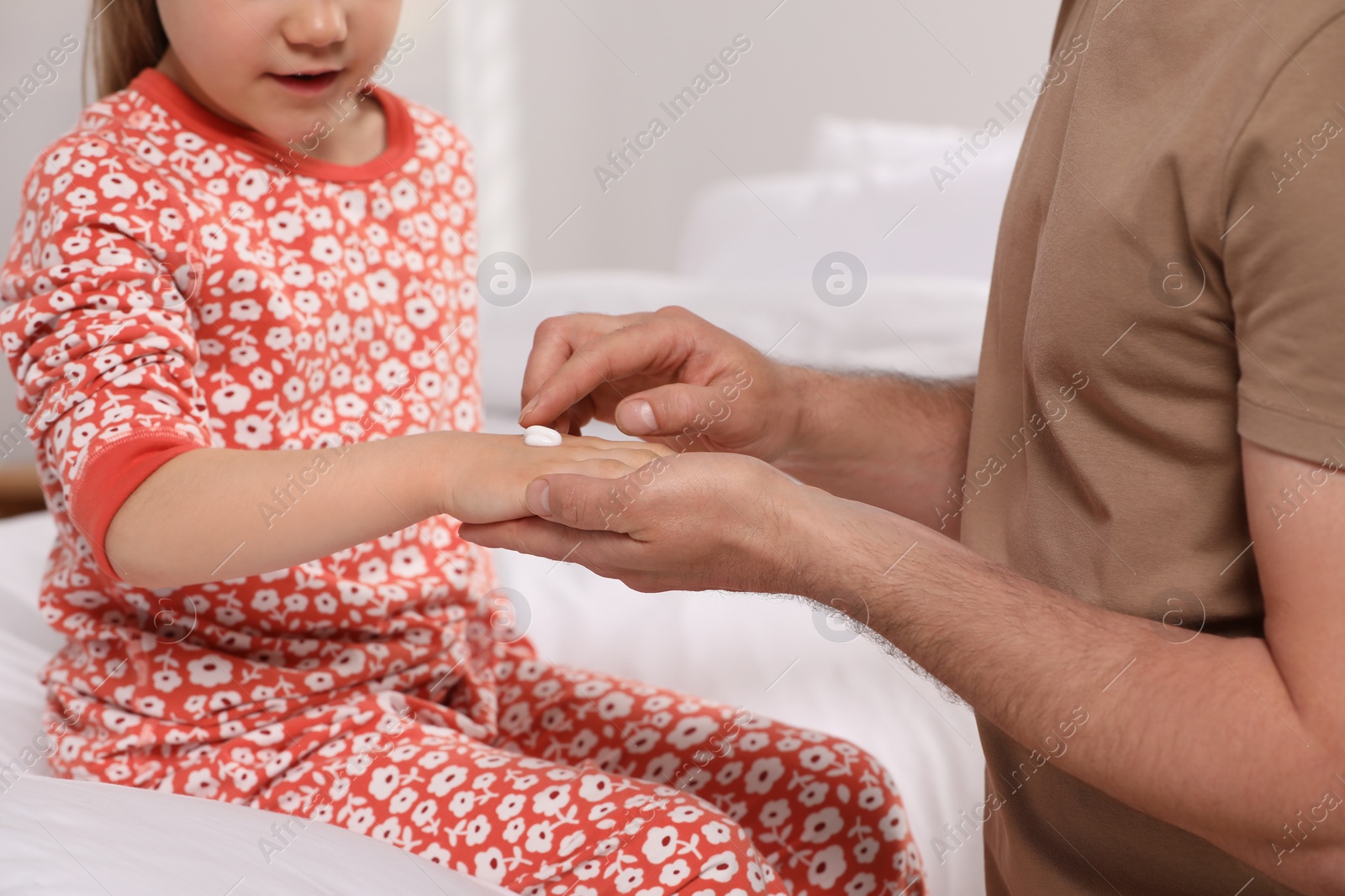 Photo of Father applying ointment onto his daughter's hand on bed, closeup