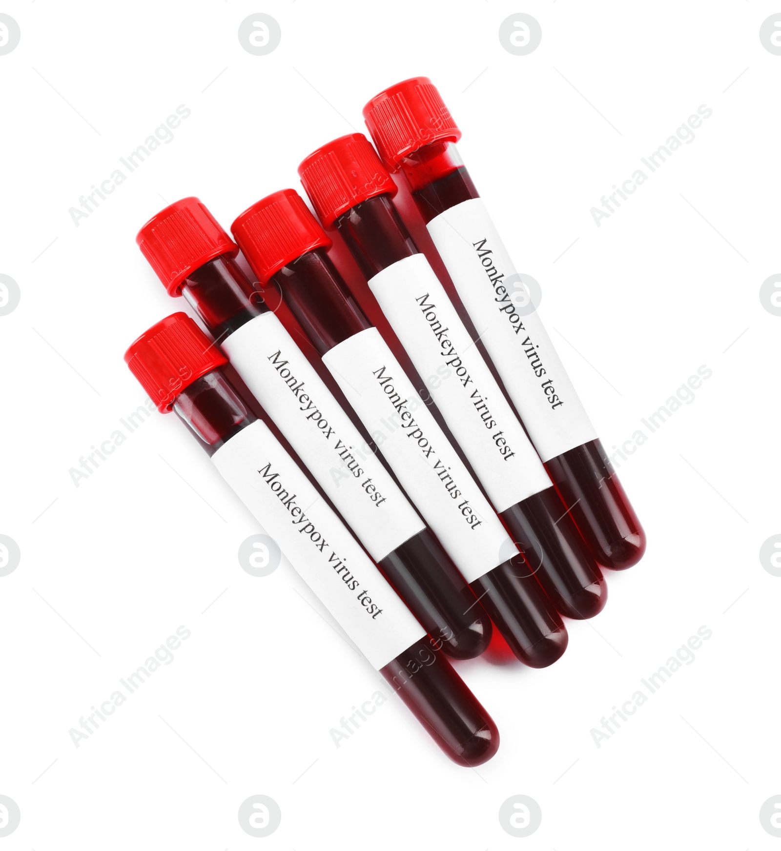 Photo of Monkeypox virus test. Sample tubes with blood on white background, top view