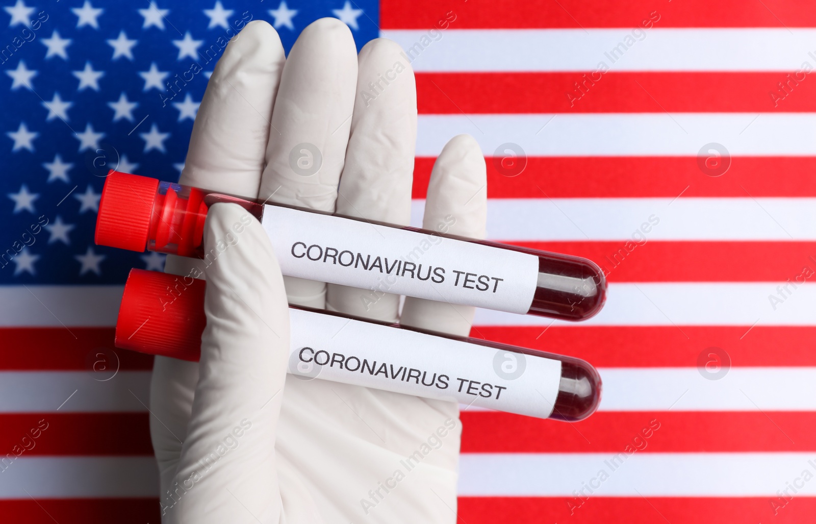 Photo of Scientist holding test tubes with blood samples over American flag, closeup. Coronavirus pandemic in USA