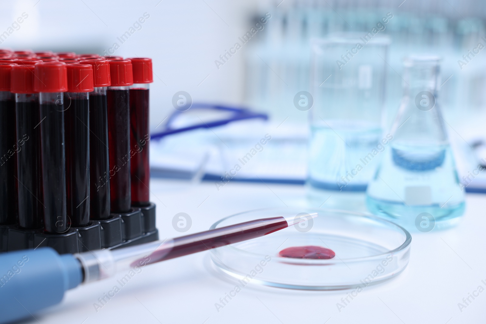 Photo of Dripping blood sample onto Petri dish on white table in laboratory, closeup