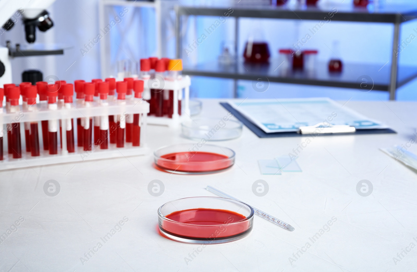 Photo of Test tubes and Petri dishes with blood samples for analysis on table in laboratory