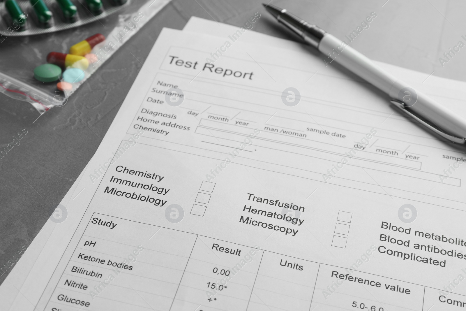 Photo of Drug test result form, pills and pen on grey table, closeup