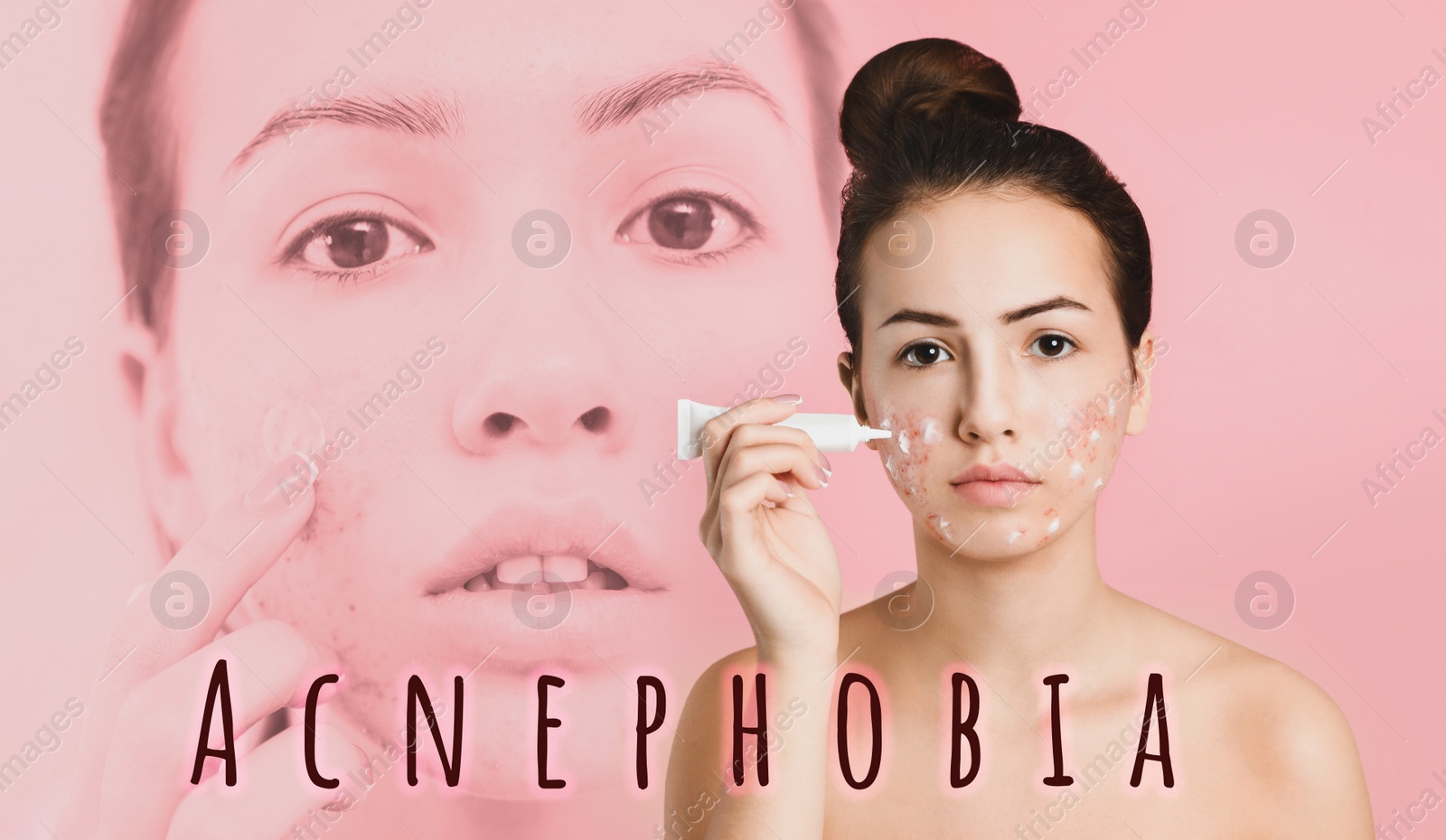 Image of Teenage girl with problem skin applying cream on light pink background. Acnephobia