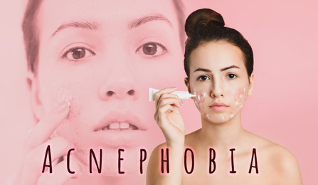 Image of Teenage girl with problem skin applying cream on light pink background. Acnephobia