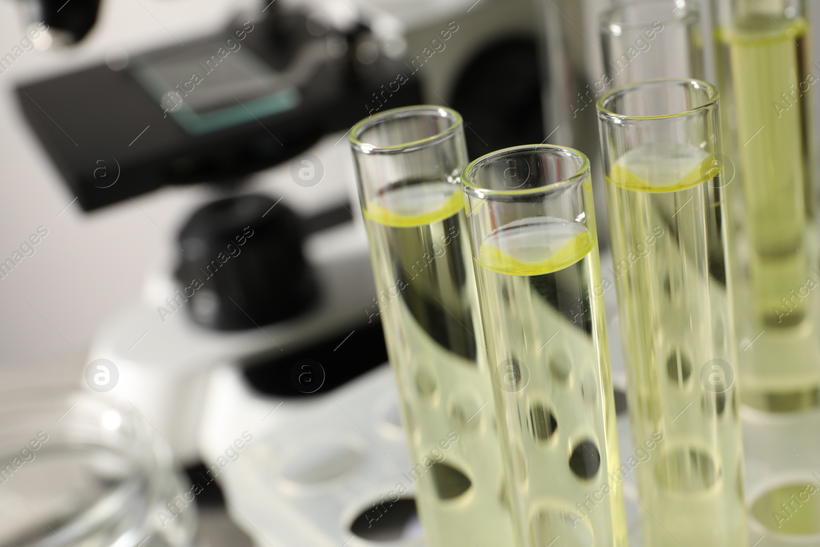 Photo of Test tubes with urine samples for analysis in holder near microscope, closeup