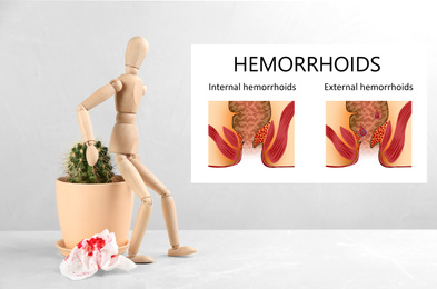 Image of Hemorrhoids. Wooden human figure near cactus and illustrations of unhealthy lower rectum