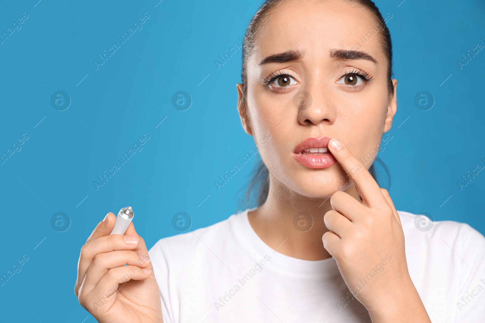 Photo of Emotional woman with herpes applying cream on lips against light blue background