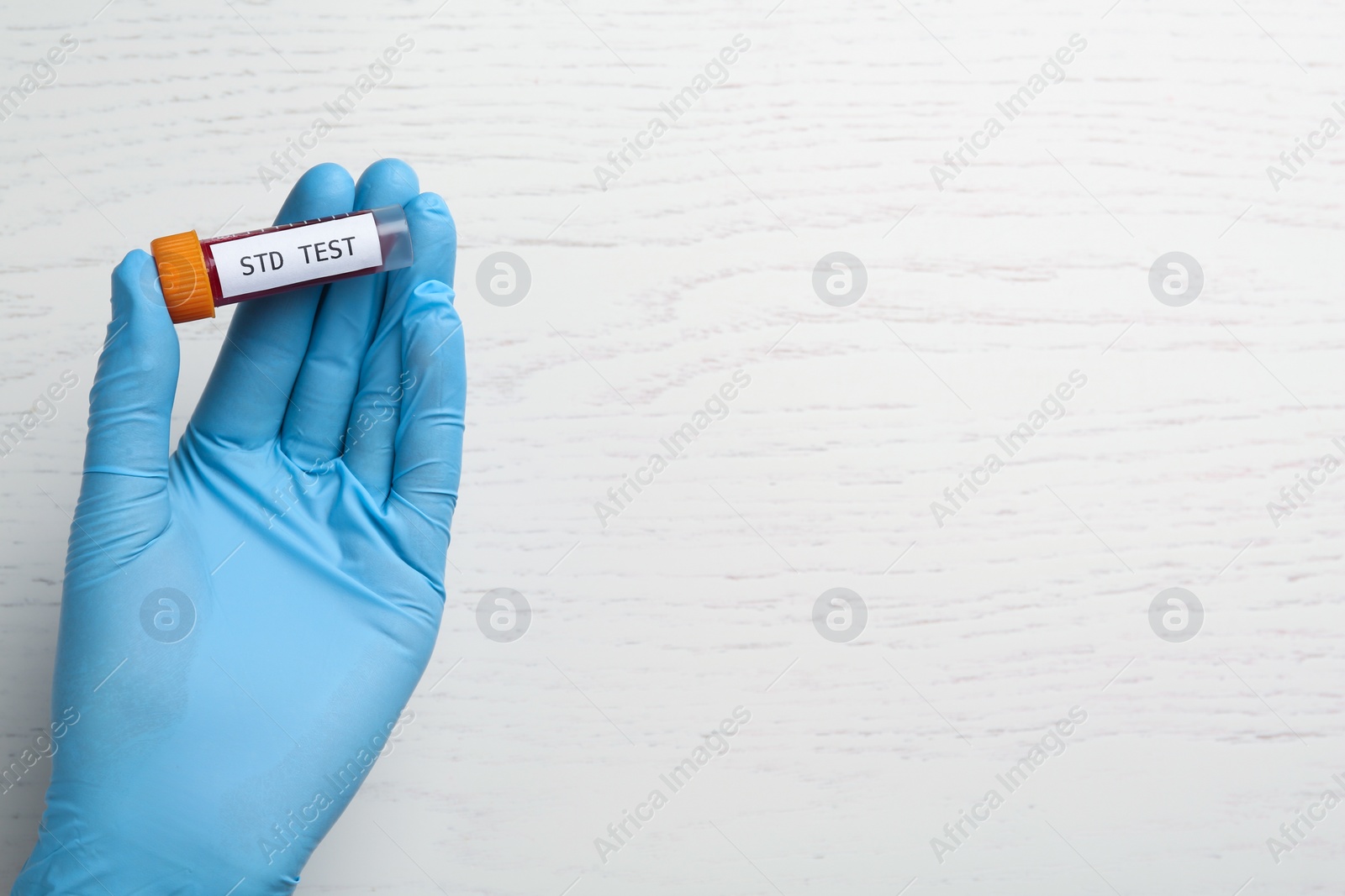 Photo of Scientist holding tube with blood sample and label STD Test at white wooden table, top view. Space for text