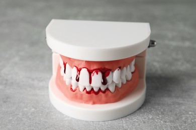 Model of jaw with blood on light grey table, closeup. Gum inflammation