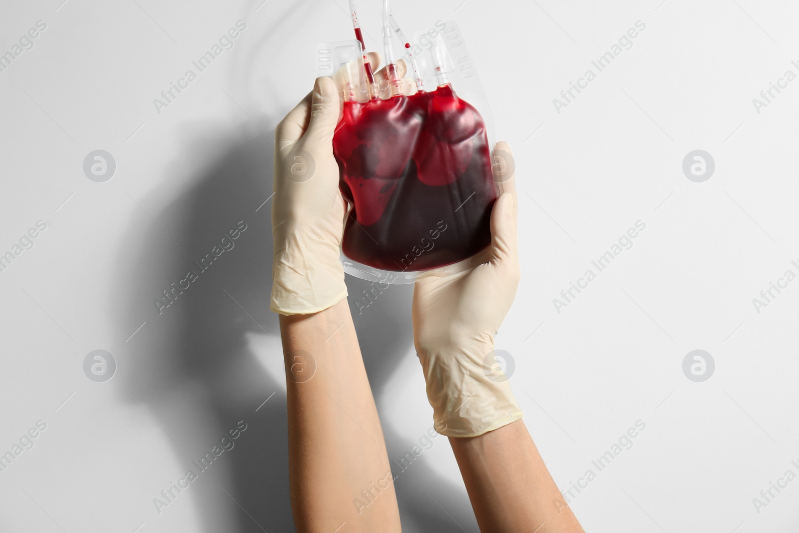 Photo of Woman holding blood for transfusion on light background, closeup. Donation concept