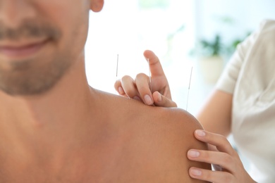 Young man undergoing acupuncture treatment in salon, closeup