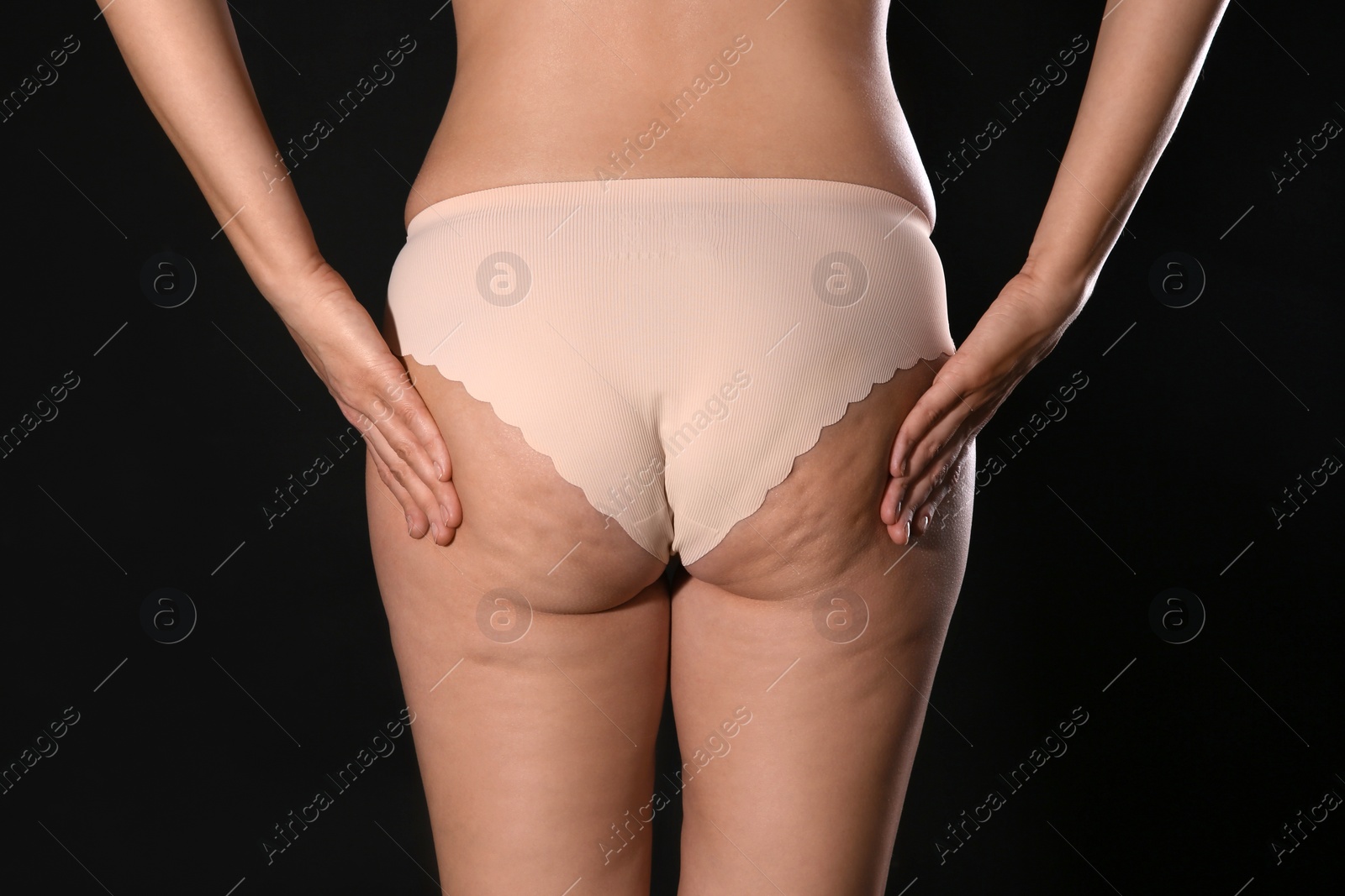 Photo of Woman with cellulite on black background, closeup