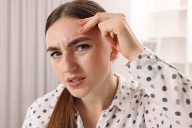 Photo of Young woman with skin problem at home