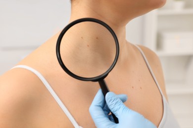 Photo of Dermatologist examining patient's birthmark with magnifying glass indoors, closeup