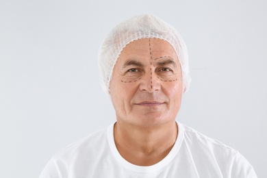 Portrait of senior man with marks on face preparing for cosmetic surgery against white background