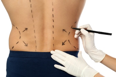 Doctor drawing marks on man's body for cosmetic surgery operation against white background, closeup