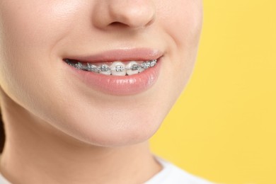 Photo of Smiling woman with dental braces on yellow background, closeup