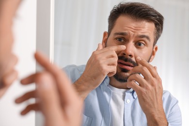 Photo of Confused man with skin problem looking at mirror indoors