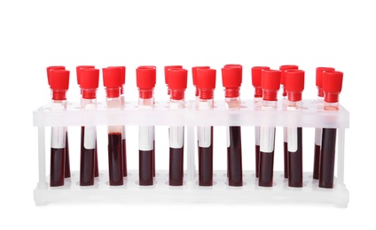 Photo of Test tubes with blood samples in rack isolated on white. Laboratory analysis