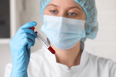 Monkeypox virus test. Laboratory worker holding sample tube with blood indoors, focus on hand