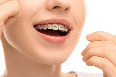 Photo of Woman with braces cleaning teeth using dental floss on white background, closeup