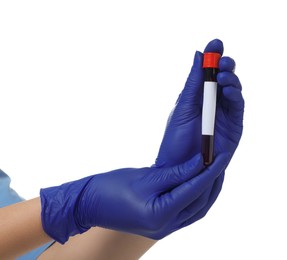 Photo of Laboratory testing. Doctor with blood sample in tube on white background, closeup