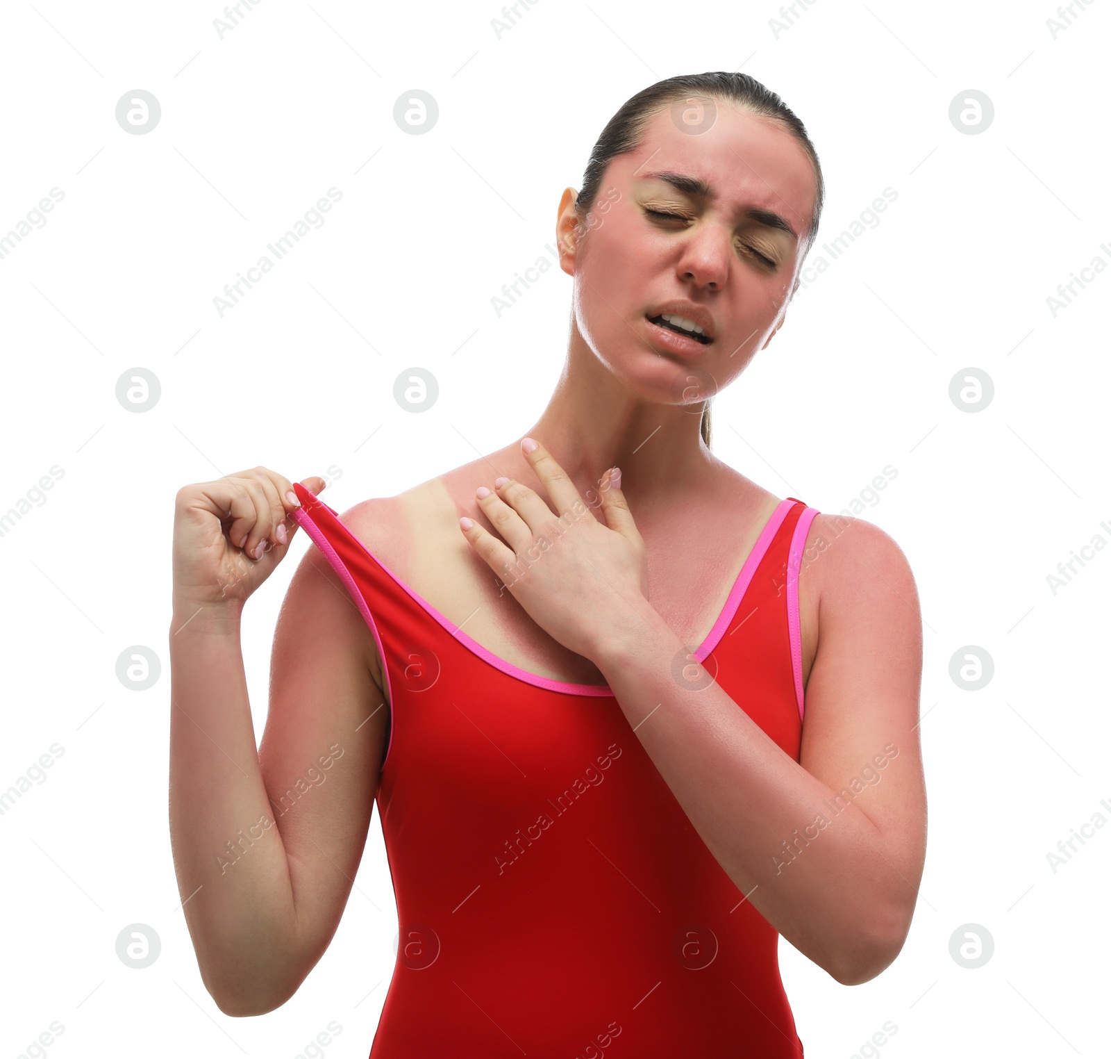 Photo of Woman with sunburned skin on white background