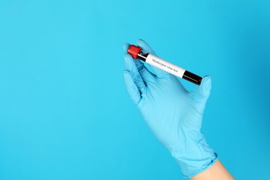 Photo of Monkeypox virus diagnosis. Laboratory worker holding test tube with blood sample on light blue background, closeup and space for text