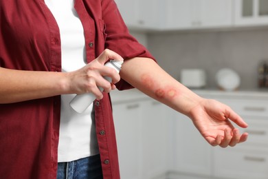 Photo of Woman applying panthenol onto burns on her hand in kitchen, closeup