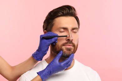 Man preparing for cosmetic surgery, pink background. Doctor drawing markings on his face, closeup