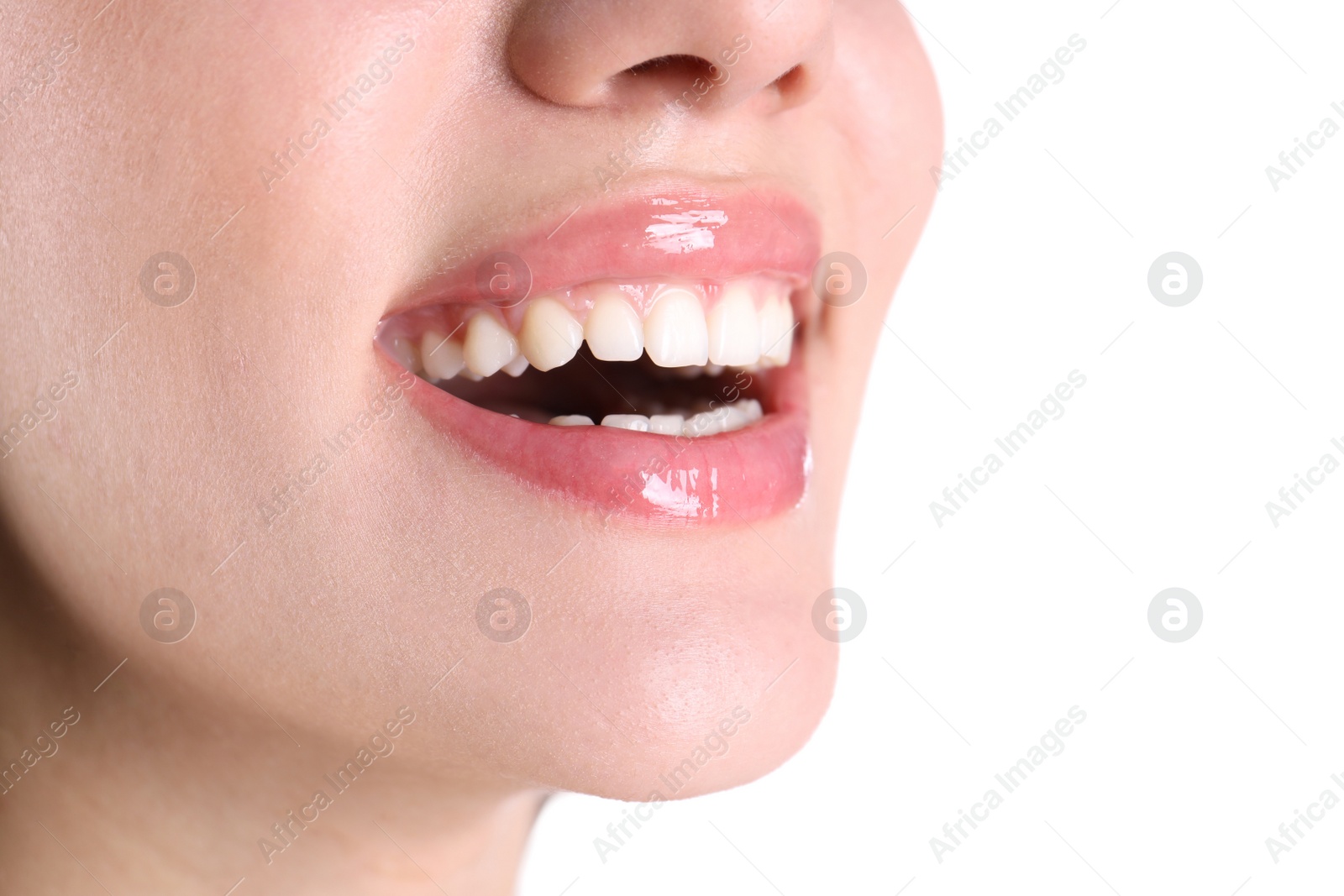 Photo of Young woman with healthy teeth smiling on white background, closeup