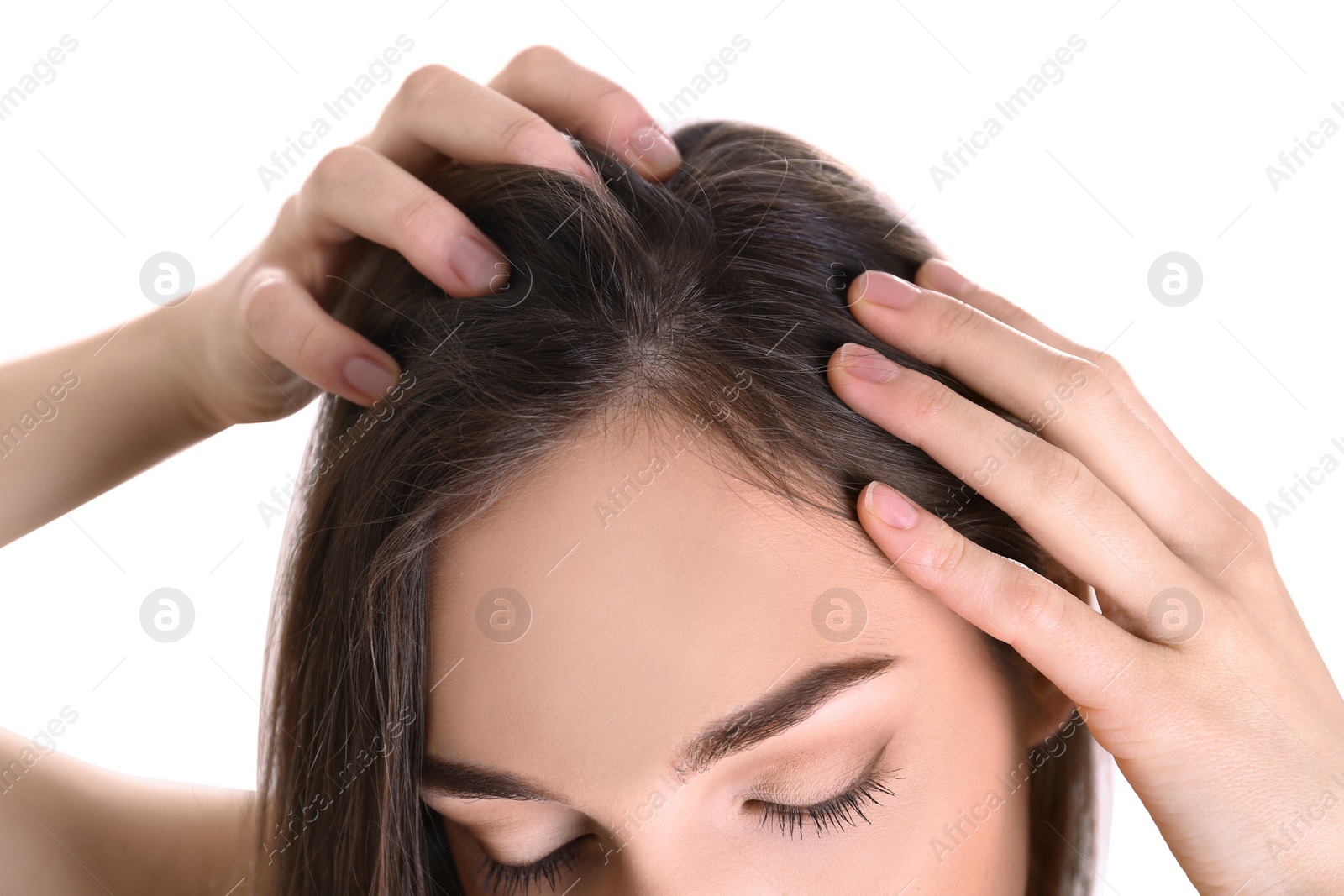 Photo of Young woman with hair loss problem on white background, closeup