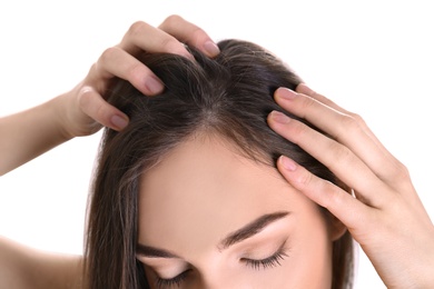 Young woman with hair loss problem on white background, closeup