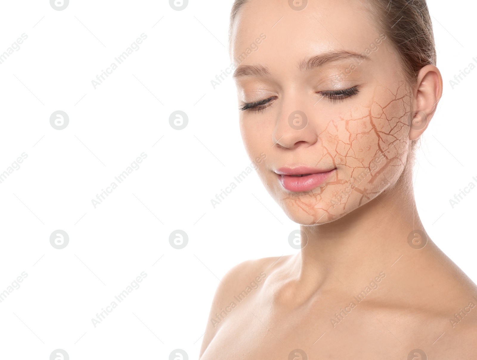 Image of Beautiful young woman with dry skin on white background