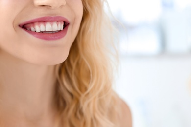 Young woman with beautiful smile indoors. Teeth whitening