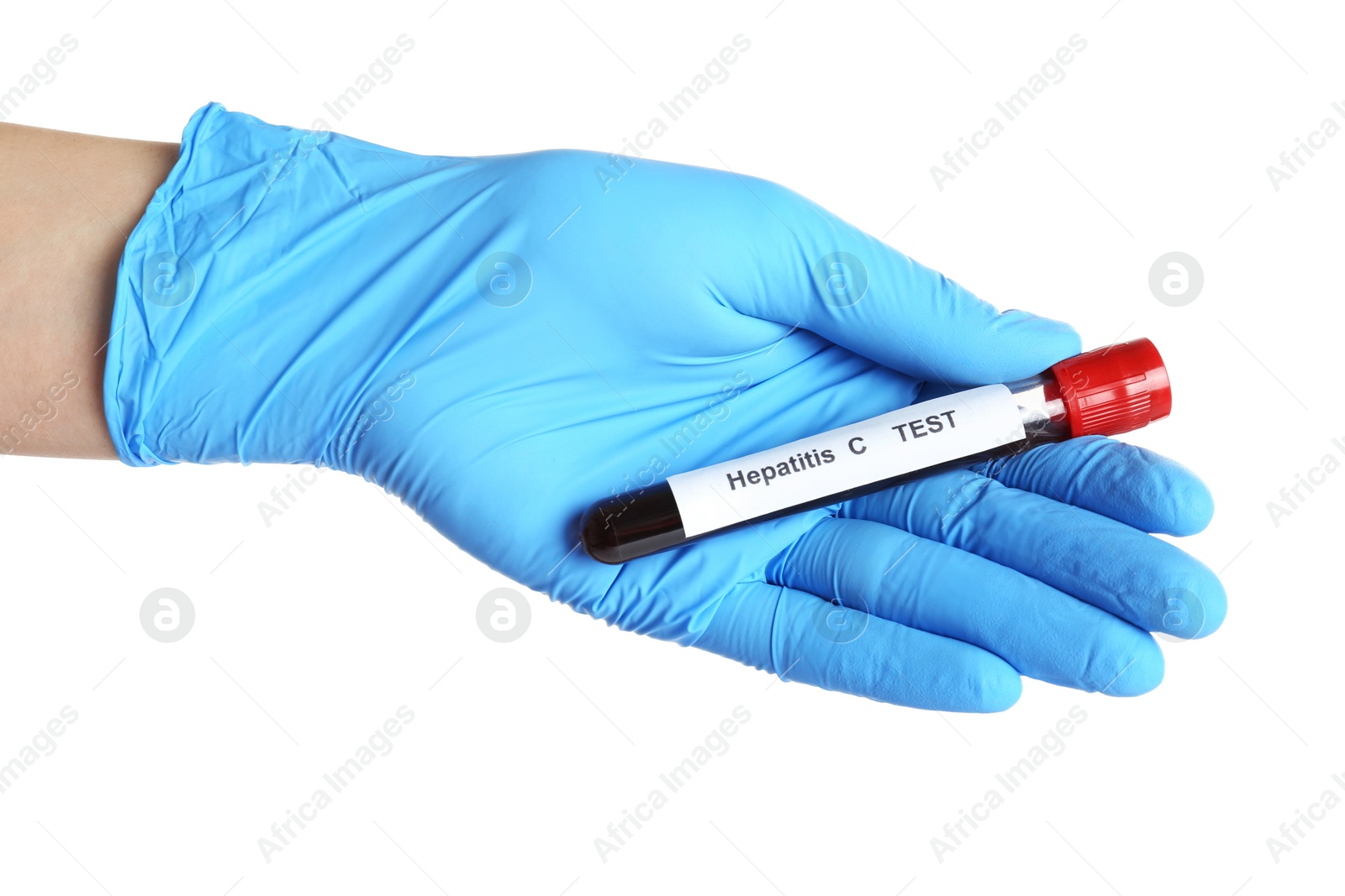 Photo of Scientist holding tube with blood sample and label Hepatitis C Test on white background, closeup