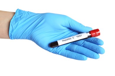 Photo of Scientist holding tube with blood sample and label Hepatitis C Test on white background, closeup