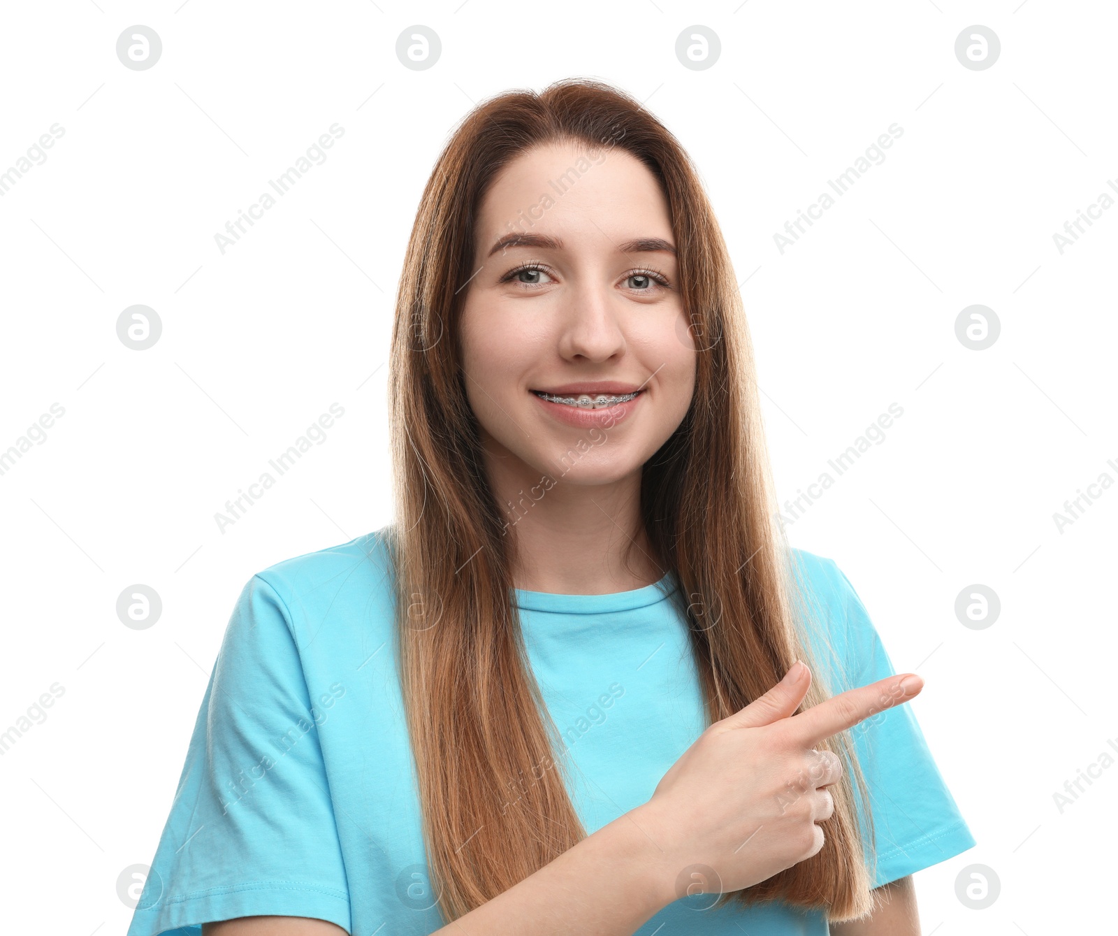 Photo of Portrait of smiling woman with dental braces pointing at something on white background