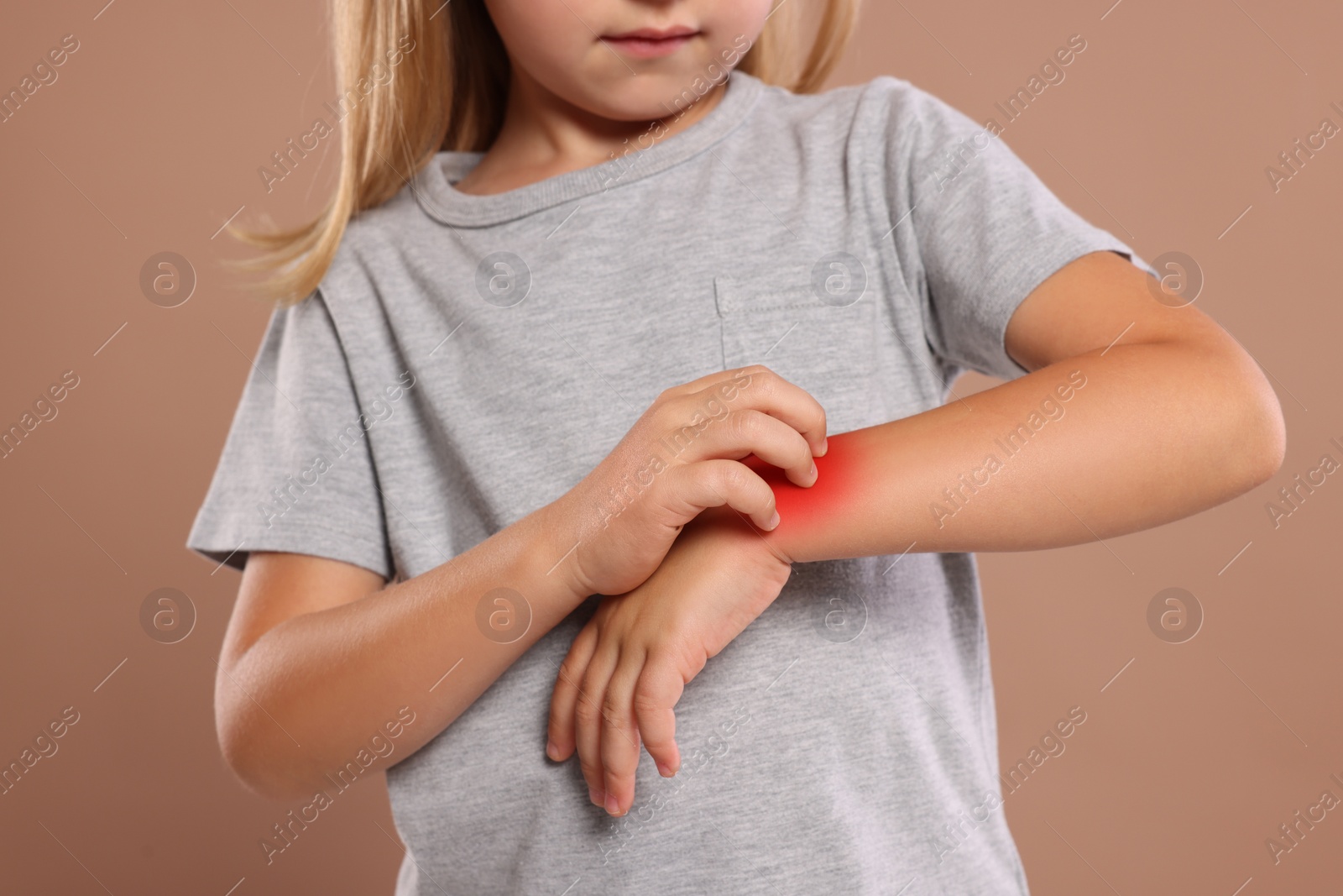 Photo of Suffering from allergy. Little girl scratching her arm on light brown background, closeup