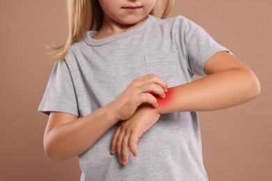 Photo of Suffering from allergy. Little girl scratching her arm on light brown background, closeup