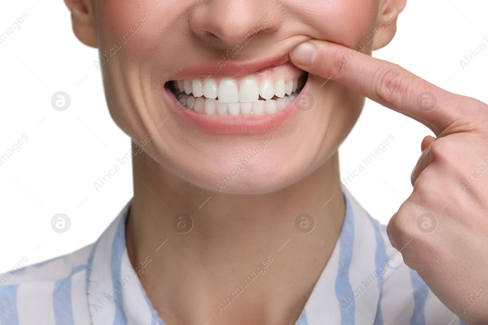 Photo of Woman showing her clean teeth on white background, closeup