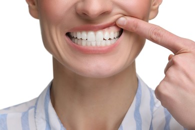 Woman showing her clean teeth on white background, closeup