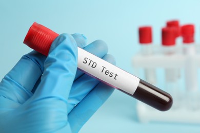 Photo of Scientist holding tube with blood sample and label STD Test on light blue background, closeup