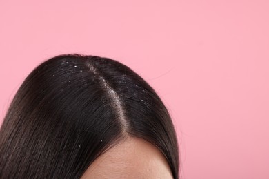 Woman with dandruff in her dark hair on pink background, closeup. Space for text