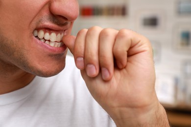 Photo of Man biting his nails indoors, closeup. Bad habit