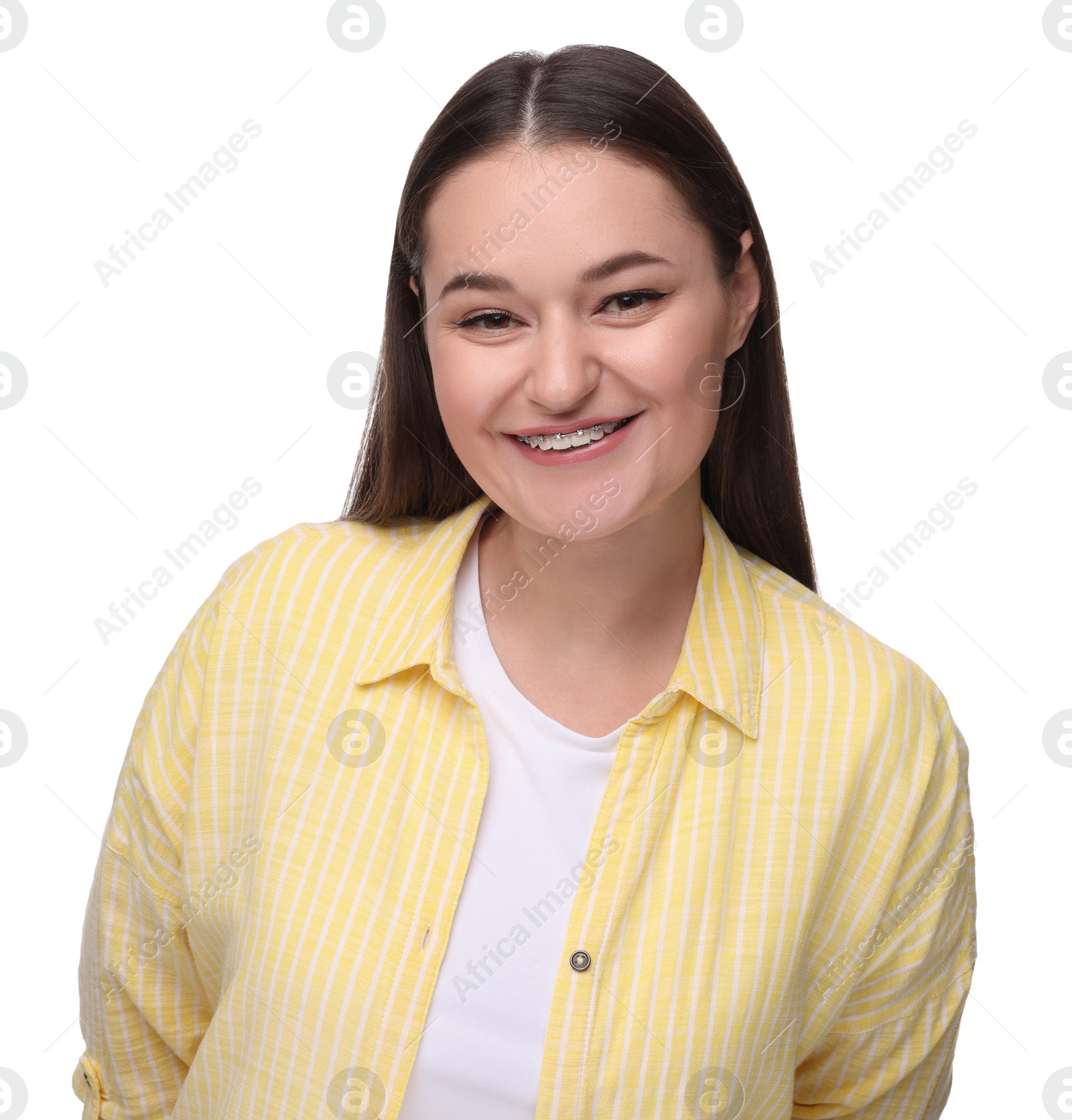 Photo of Smiling woman with dental braces on white background