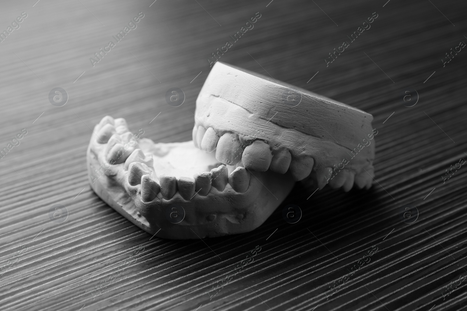 Photo of Dental model with gums on grey wooden table. Cast of teeth