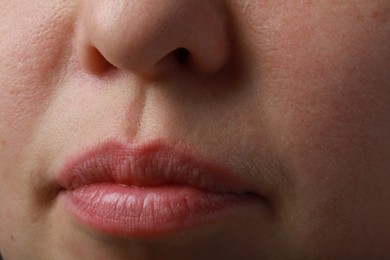 Photo of Closeup view of woman with normal skin and beautiful lips